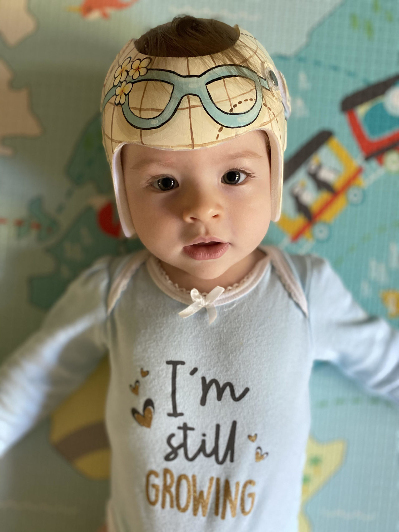 Why Does My Baby Girl Need to Wear a Helmet helmet journey